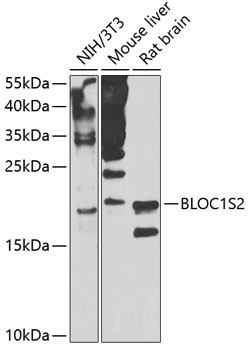 BLOC1S2 Rabbit Polyclonal Antibody