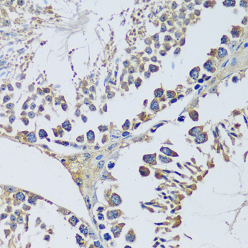 BLOC1S3 Rabbit Polyclonal Antibody - Image 2