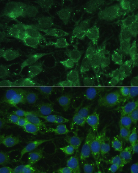 BLOC1S3 Rabbit Polyclonal Antibody - Image 3