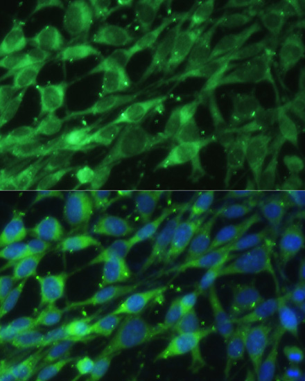 BLOC1S3 Rabbit Polyclonal Antibody - Image 4