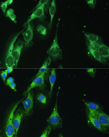 BLOC1S3 Rabbit Polyclonal Antibody - Image 5