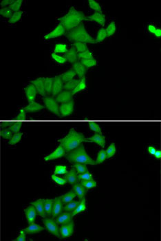 BLZF1 Rabbit Polyclonal Antibody - Image 2