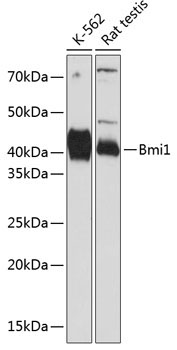Bmi1 Rabbit Monoclonal Antibody