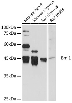 Bmi1 Rabbit Polyclonal Antibody - Image 2