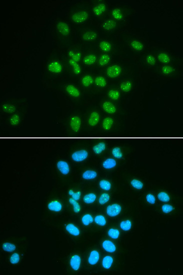 Bmi1 Rabbit Polyclonal Antibody - Image 2