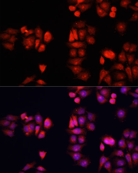 BMP1 Rabbit Polyclonal Antibody