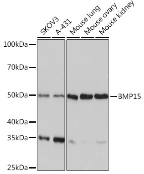 BMP15 Rabbit Monoclonal Antibody