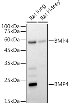 BMP4 Rabbit Polyclonal Antibody