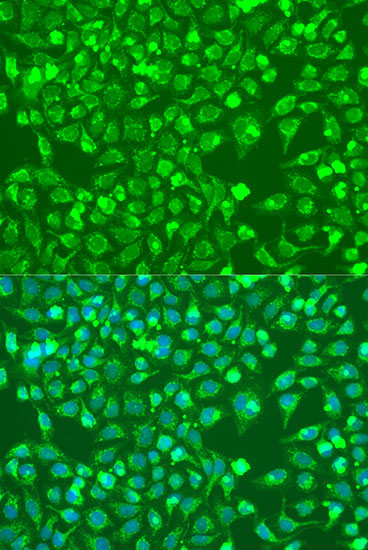 BMP6 Rabbit Polyclonal Antibody