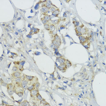 BMPR1B Rabbit Polyclonal Antibody