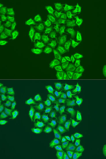 BNIP3 Rabbit Polyclonal Antibody