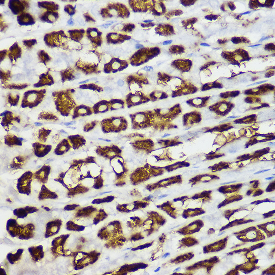 BNIP3 Rabbit Polyclonal Antibody - Image 2