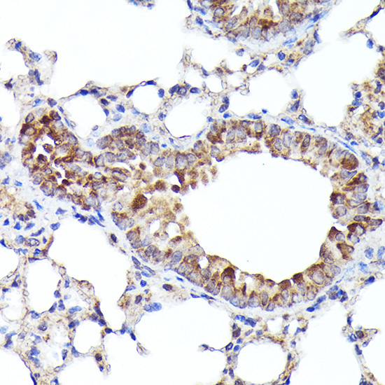 BNIP3L Rabbit Polyclonal Antibody - Image 2