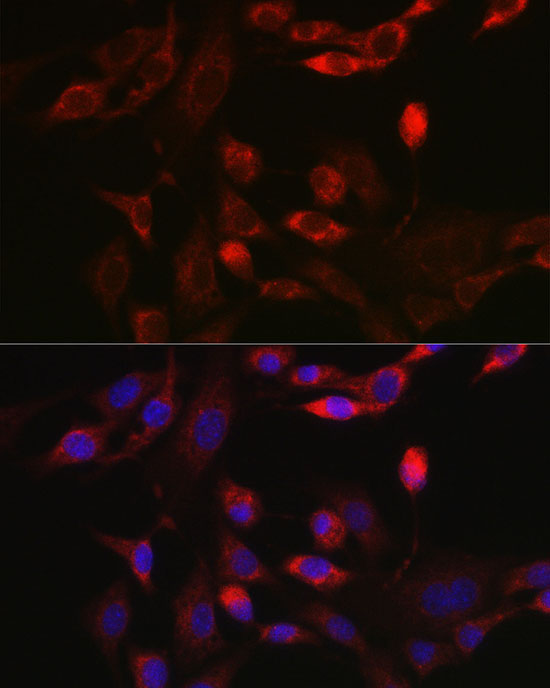 BNIP3L Rabbit Polyclonal Antibody - Image 4
