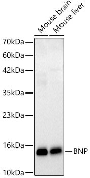 BNP Rabbit Monoclonal Antibody