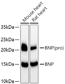 BNP Rabbit Polyclonal Antibody