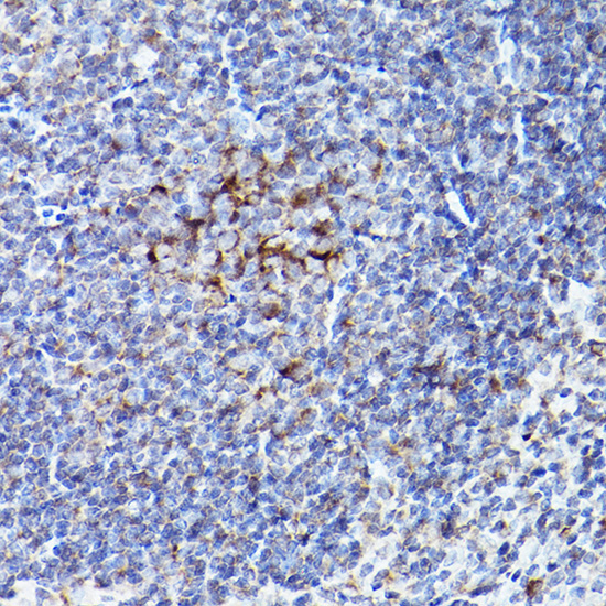 BOK Rabbit Polyclonal Antibody - Image 2