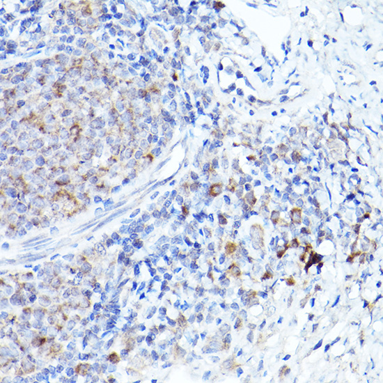 BOK Rabbit Polyclonal Antibody - Image 3