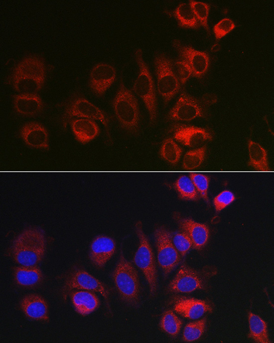 BOK Rabbit Polyclonal Antibody - Image 5
