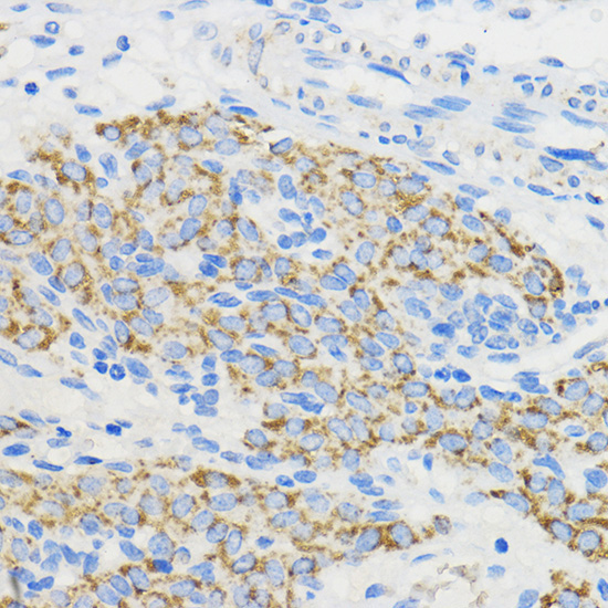 BOLA3 Rabbit Polyclonal Antibody - Image 3