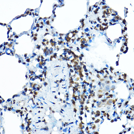 BOP1 Rabbit Polyclonal Antibody - Image 2