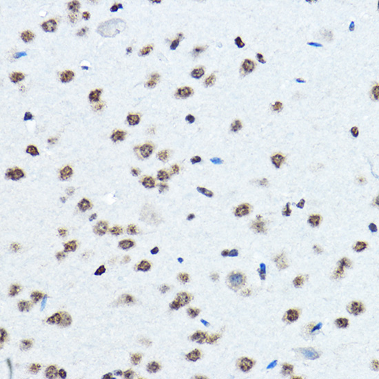 BOP1 Rabbit Polyclonal Antibody - Image 3