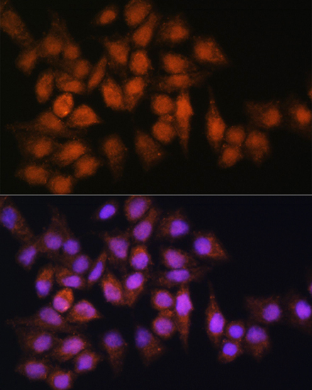 BPGM Rabbit Polyclonal Antibody - Image 2