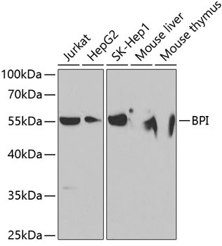 BPI Rabbit Polyclonal Antibody