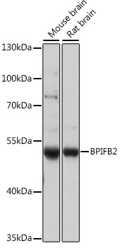 BPIFB2 Rabbit Polyclonal Antibody