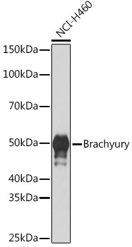 Brachyury Rabbit Monoclonal Antibody