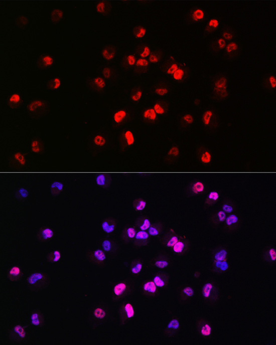 Brachyury Rabbit Polyclonal Antibody - Image 2