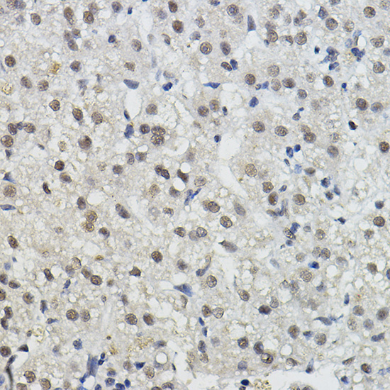 BRAP Rabbit Polyclonal Antibody - Image 3
