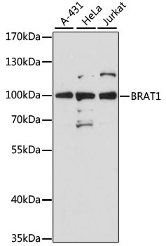 BRAT1 Rabbit Polyclonal Antibody