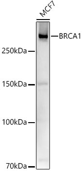BRCA1 Rabbit Polyclonal Antibody