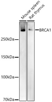 BRCA1 Rabbit Polyclonal Antibody - Image 2