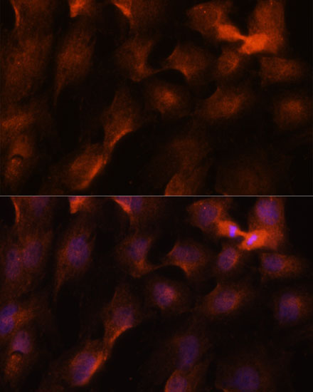 BRCA1 Rabbit Polyclonal Antibody - Image 3