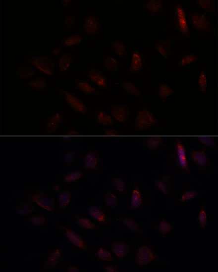 BRCA1 Rabbit Polyclonal Antibody - Image 4