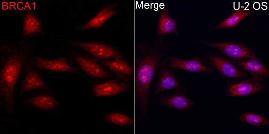 BRCA1 Rabbit Polyclonal Antibody