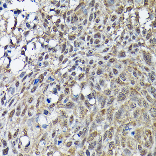BRCA1 Rabbit Polyclonal Antibody