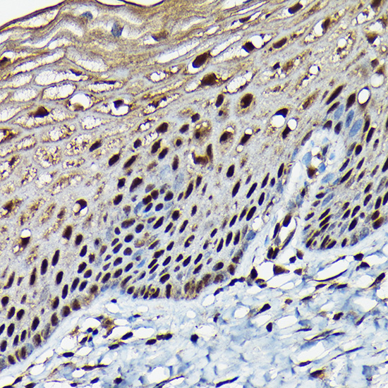 BRCA1 Rabbit Polyclonal Antibody - Image 2