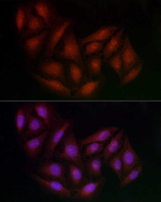 BRCA1 Rabbit Polyclonal Antibody - Image 3