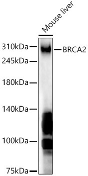 BRCA2 Rabbit Polyclonal Antibody