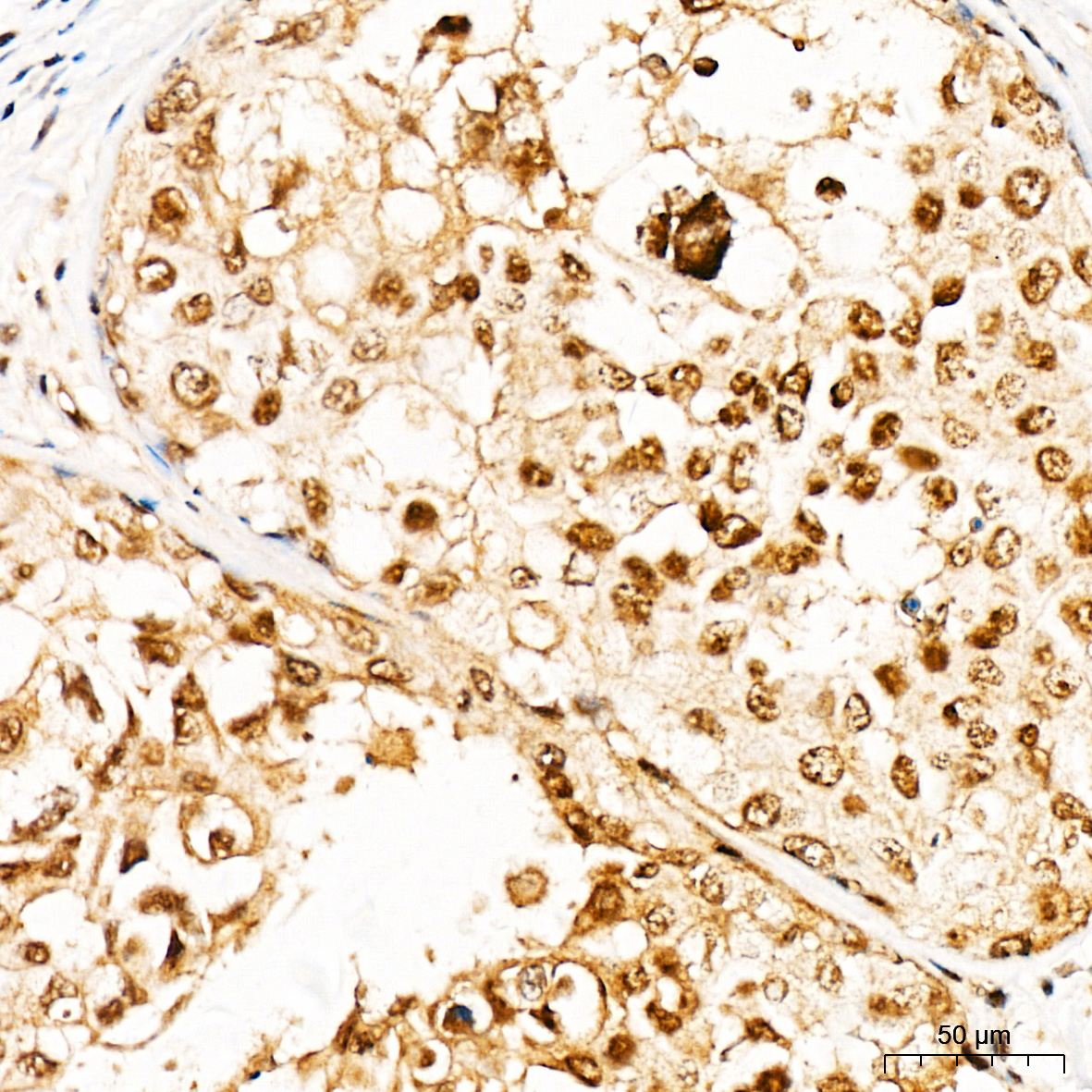 BRCA2 Rabbit Polyclonal Antibody - Image 2