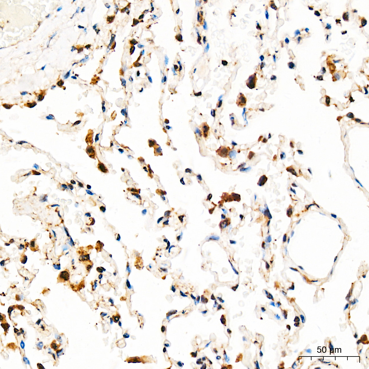BRCA2 Rabbit Polyclonal Antibody - Image 3