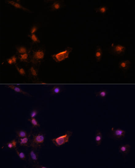 BRCA2 Rabbit Polyclonal Antibody - Image 4