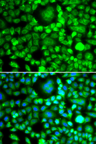 BRCC2/BLID Rabbit Polyclonal Antibody - Image 2