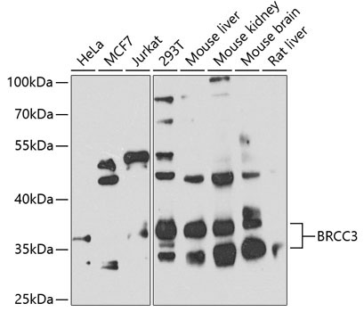 BRCC3 Rabbit Polyclonal Antibody