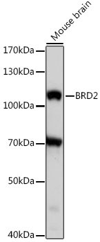 BRD2 Rabbit Polyclonal Antibody