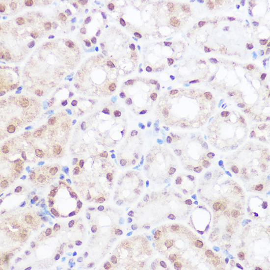 BRD2 Rabbit Polyclonal Antibody - Image 3