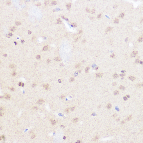 BRD2 Rabbit Polyclonal Antibody - Image 4